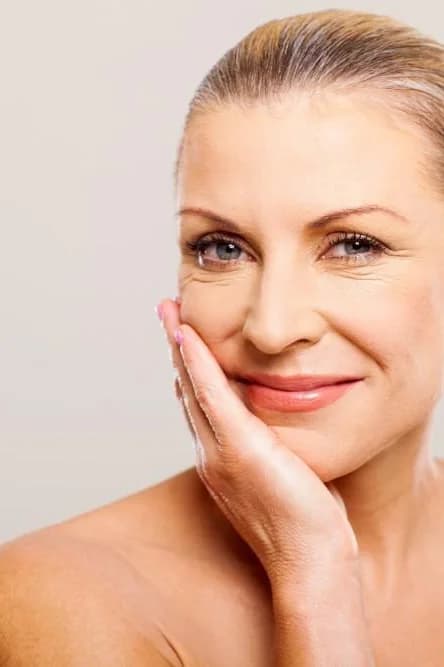 Bellafill® — Injectables at Skin Med Spa