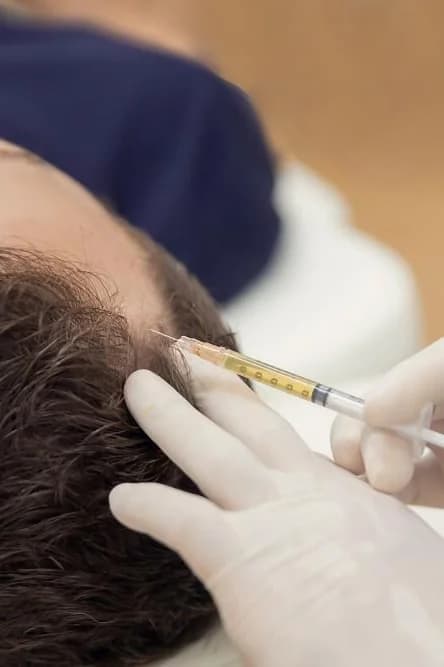 Hair Restoration at Skin Med Spa